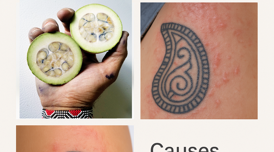 Understanding Jagua Allergies: Causes, Symptoms, and Prevention